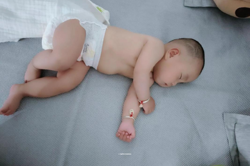 吉安六个月宝宝眼睛散光